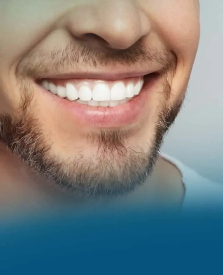 ابتسامة هوليود ونتائجها في الحصول على ابتسامة صحية ومشرقة وبتكاليف مناسبة.