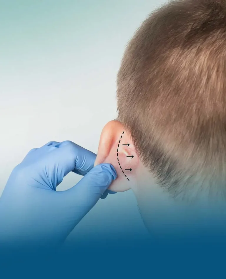 عملية إصلاح عيوب الأذن وتجميلها لتستعيد صفاء سمعك، وتنعم بفوائد وميزات كثيرة.