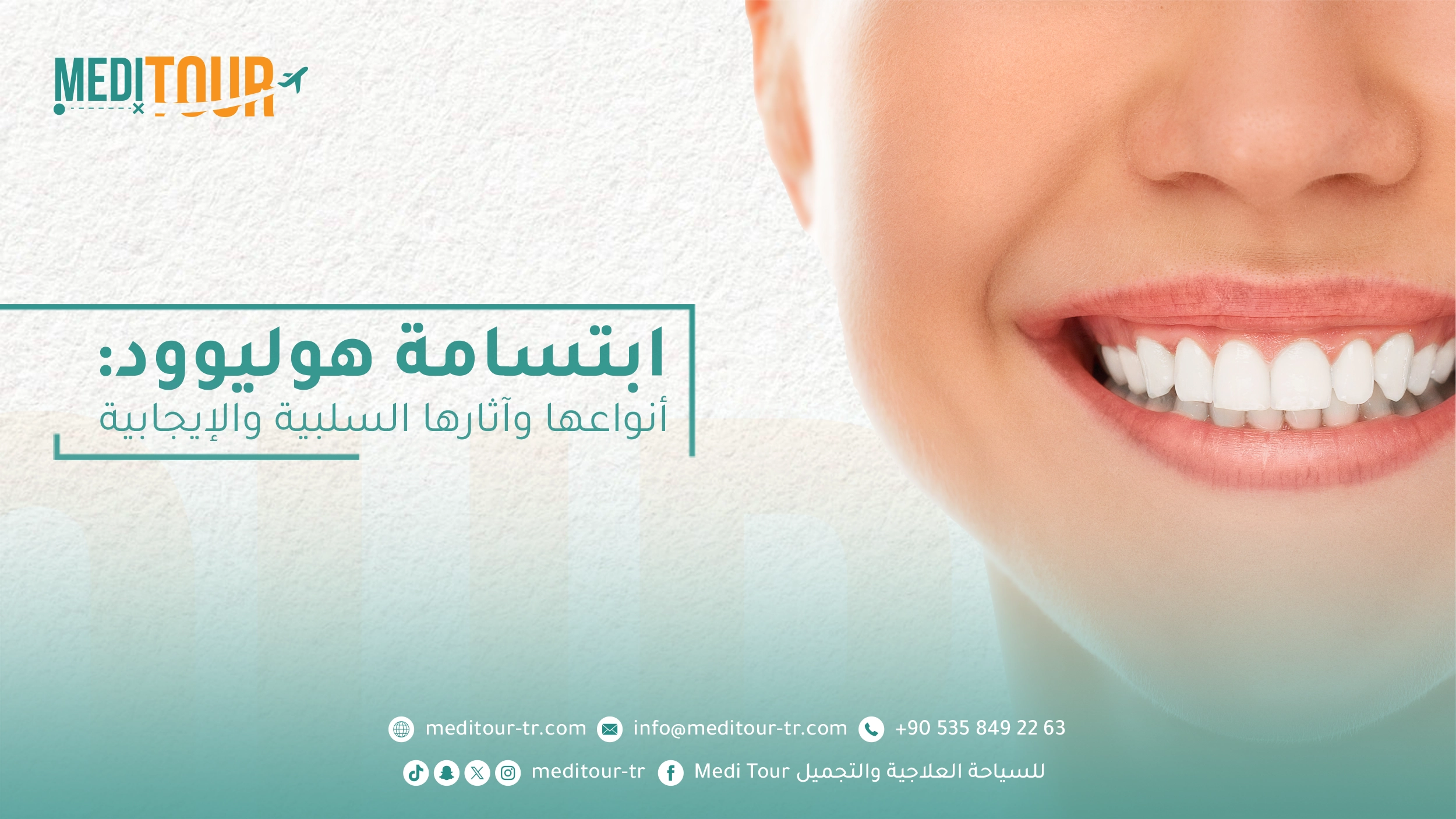 ابتسامة هوليوود: ما هي أنواعها وفوائدها؟