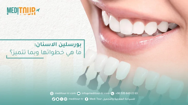 بورسلين الاسنان وتركيبها