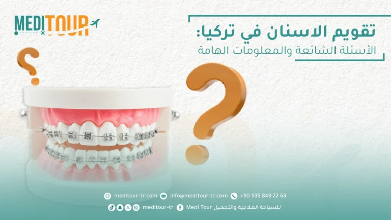 تقويم الاسنان في تركيا الحل لاستعادة الابتسامة الصحية