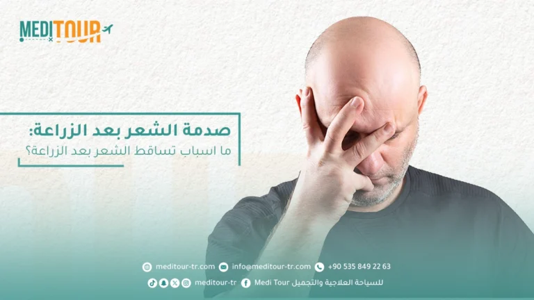 تساقط الشعر بعد الزراعة متى يكون طبيعي ومتى يجب علينا القلق