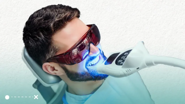 يتميز تبيض الأسنان عند الطبيب بأنه أكثر فعالية من التبييض المنزلي.