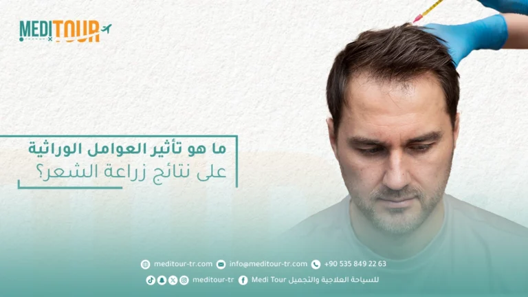 تأثير العوامل الوراثية على نتائج عملية زراعة الشعر