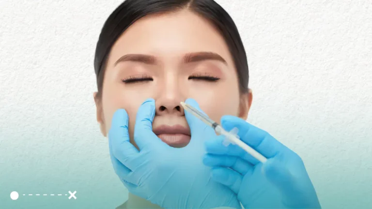 الفيلر للانف تقنية متقدمة غير جراحية تستخدم لتحسين شكل الانف وتصحيح العيوب البسيطة.