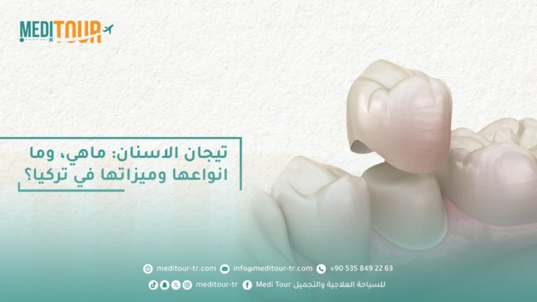 انواع تيجان الاسنان وميزاتها