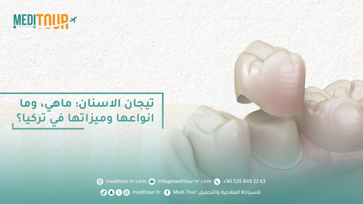 انواع تيجان الاسنان وميزاتها
