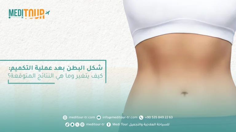 شكل البطن بعد عملية التكميم