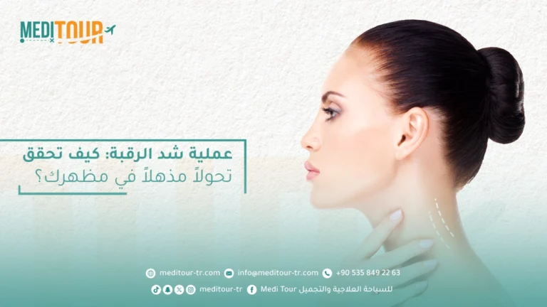 عملية شد الرقبة في تركيا