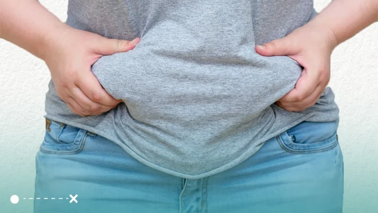 علاج السمنة المفرطة أمر مهم للغاية وذلك لتجنب آثارها السلبية.