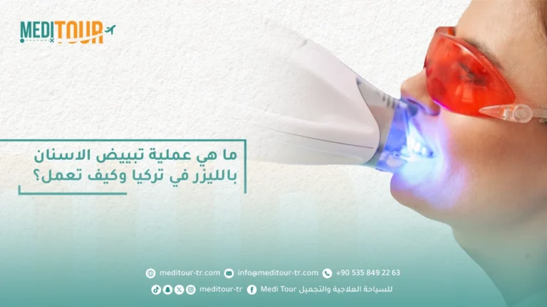 عملية تبييض الأسنان بالليزر في تركيا