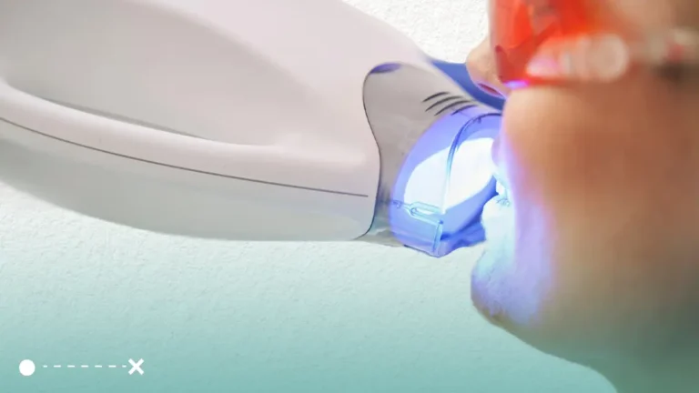 ما هي اضرار تبييض الاسنان بالليزر؟ وكيف يمكن أن نخفف من هذه الاضرار؟
