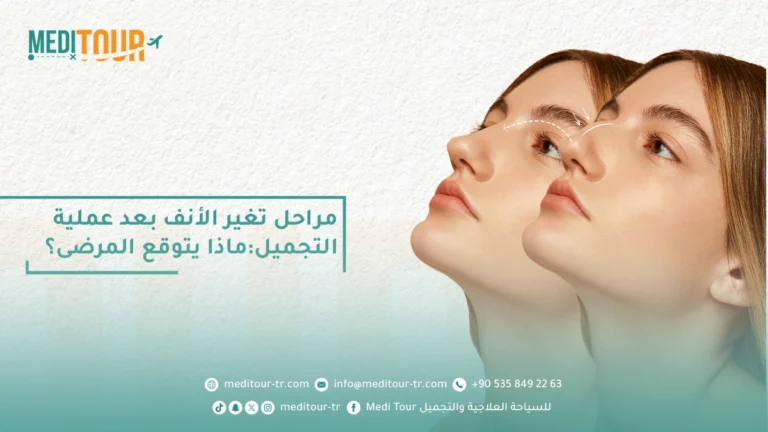 مراحل تغير الأنف بعد عملية التجميل