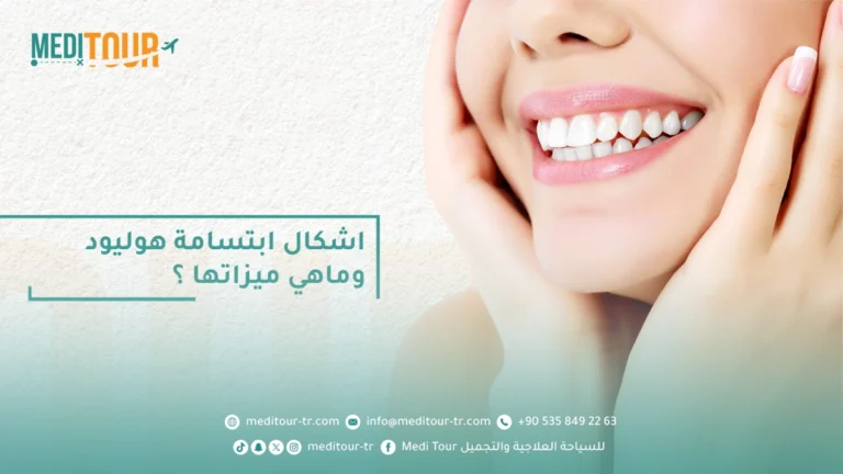 هناك عدة اشكال ابتسامة هوليود التي تعتبر رمزاً للثقة والجاذبية.