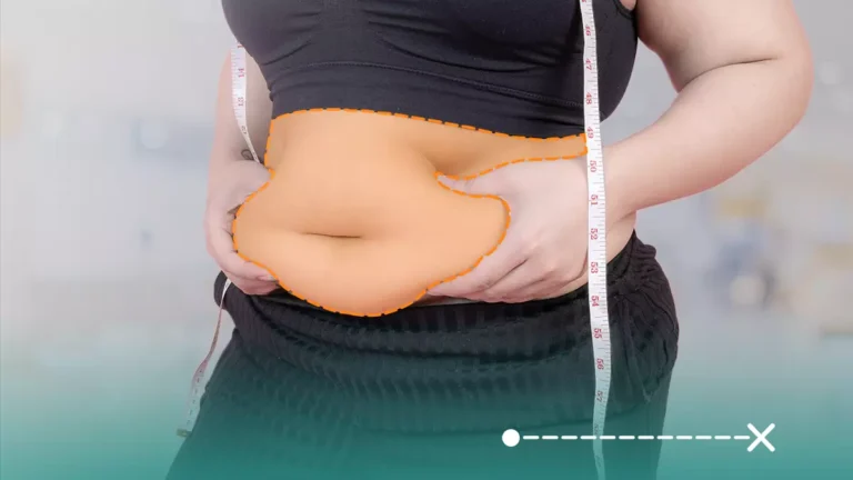 نكسير الدهون في تركيا علاج فعال وناجح للتخلص من الدهون المتراكمة في الجسم.