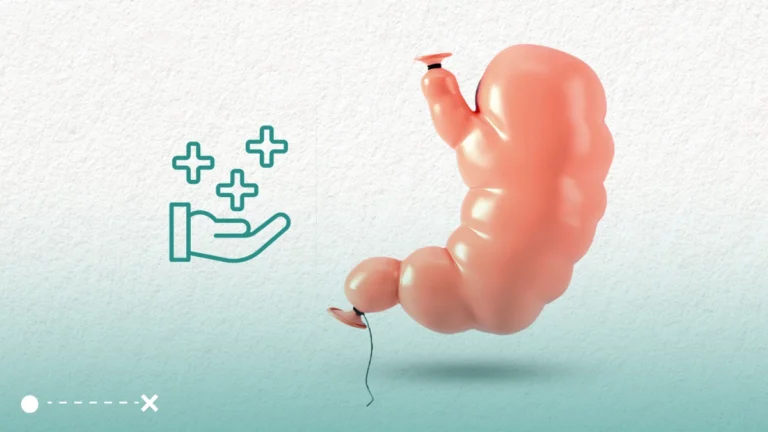 يعد بالون المعدة من التقنيات الغير جراحية الأمنة والفعالة لفقدان الوزن.