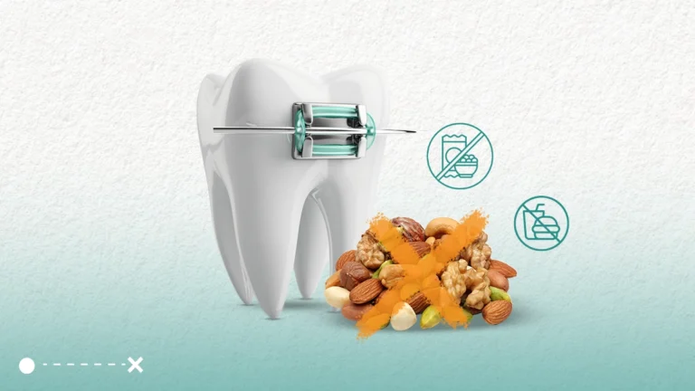 ممنوعات التقويم التي يجب الالتزام بها للحصول على أفضل النتائج