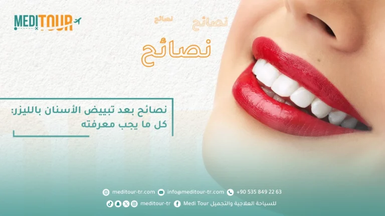 نصائح بعد تبييض الأسنان بالليزر في تركيا