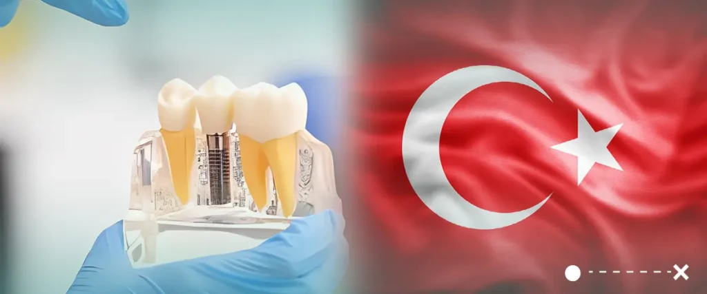 لا يمكننا تجاهل جودة الخدمات الطبية والأسعار التنافسية في تركيا حيث تعتبر أرخص دولة في زراعة الأسنان مع الحفاظ على الجودة.