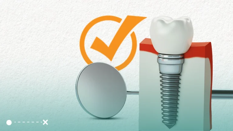 تبرز اهمية زرع الاسنان بقدرة هذه العملية على تعويض الأسنان المفقودة وتحسين صحة الفم والابتسامة.