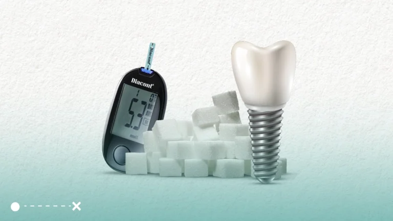 زراعة الاسنان لمريض السكر تشكل تحدياّ حقيقياً ويحتاج هذا الإجراء إلى عناية كبيرة من قبل المختصين والمريض في نفس الوقت.