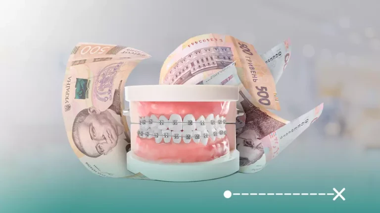 سعر تقويم الأسنان في تركيا يعتبر الأنسب والأوفر مع حفاظه على مستوى الجودة العالية.